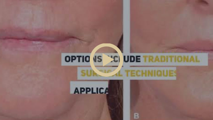 Watch Video: Fedok Plastic Surgery