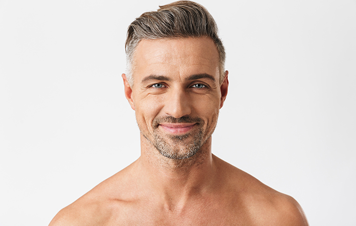 NeoGraft 2.0™ Hair Restoration Before & After Results